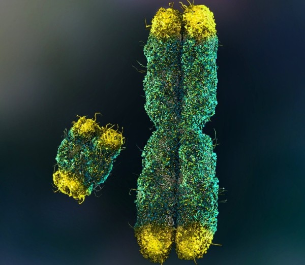 В чем причина меньшей продолжительности жизни мужчин по сравнению с женщинами