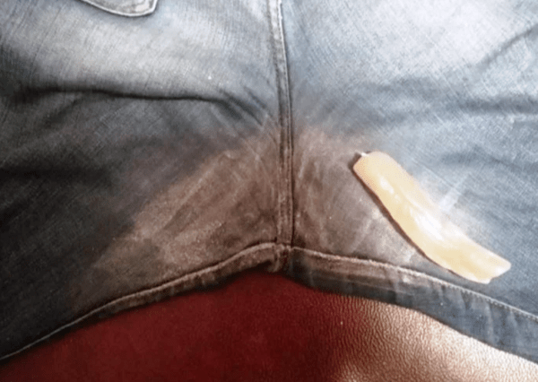 Протираются джинсы между ног: что можно предпринять Протираются джинсы между ног: что можно предпринять