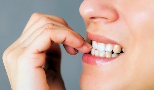 Четыре действенных способа избавиться от привычки грызть ногти Четыре действенных способа избавиться от привычки грызть ногти