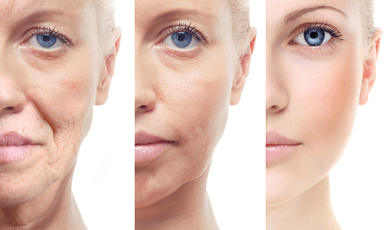 От неактуальной стрижки до хмурого взгляда: 6 привычек, которые нас старят От неактуальной стрижки до хмурого взгляда: 6 привычек, которые нас старят