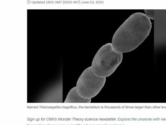 Обнаружена самая большая в мире бактерия размером с человеческую ресницу