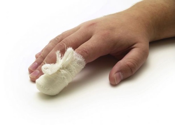 Несколько лайфхаков, как быстро вытащить занозу из пальца без иголки